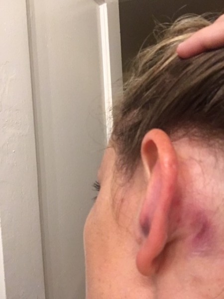 mastoid.jpg